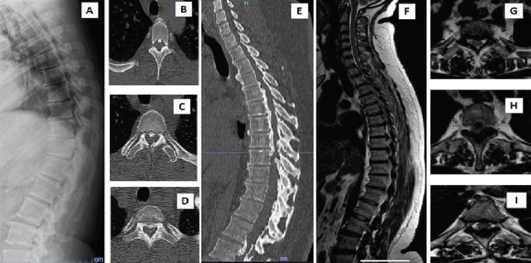 https://cdn.ncbi.nlm.nih.gov/pmc/blobs/f47d/10976529/839864f6bc38/JOCR-14-141-g001.jpg