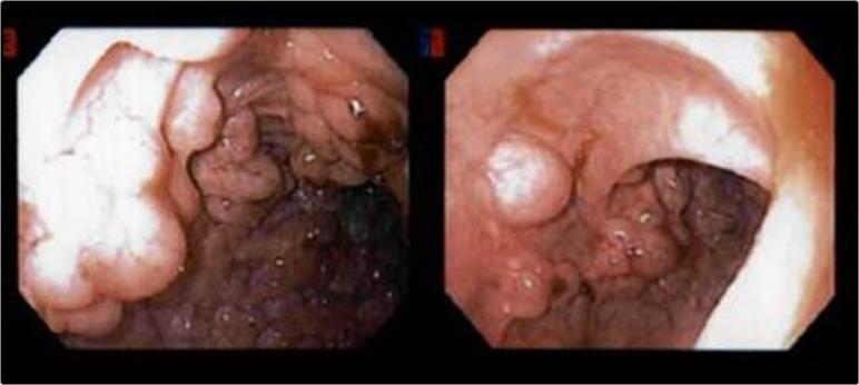 https://cdn.ncbi.nlm.nih.gov/pmc/blobs/f480/5241713/cda0be2197ff/rjw233f02.jpg