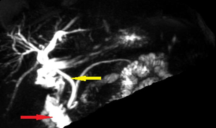 https://cdn.ncbi.nlm.nih.gov/pmc/blobs/f481/7864277/a9282badd29d/PAMJ-37-259-g003.jpg