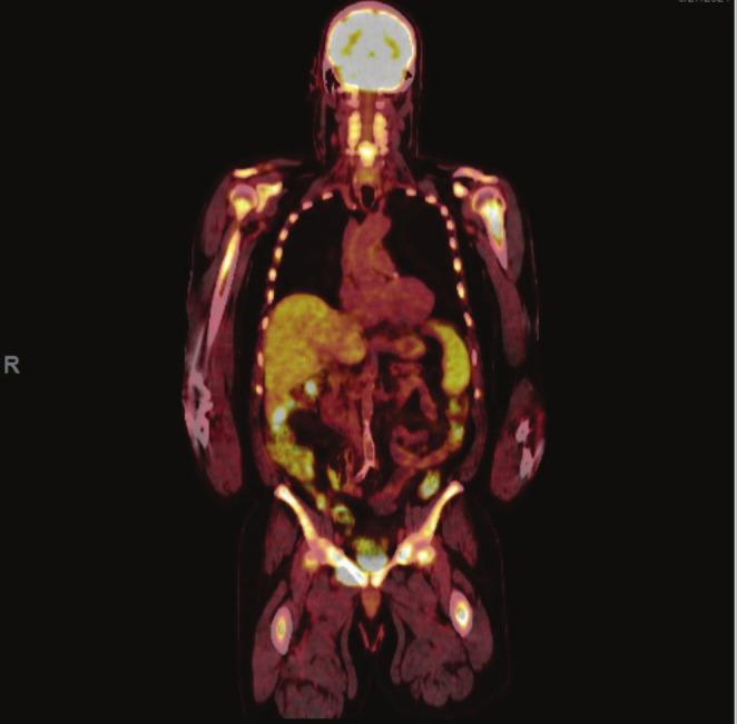 https://cdn.ncbi.nlm.nih.gov/pmc/blobs/f48d/12397492/3ca91fdb81fa/JGH3-9-e70239-g001.jpg