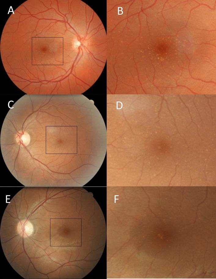 https://cdn.ncbi.nlm.nih.gov/pmc/blobs/f48e/9622730/dfef01df3022/41598_2022_21386_Fig1_HTML.jpg