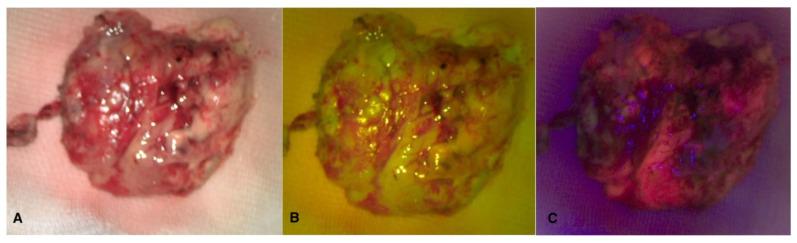 https://cdn.ncbi.nlm.nih.gov/pmc/blobs/f495/11353032/77a0f99e1520/cancers-16-02771-g004.jpg