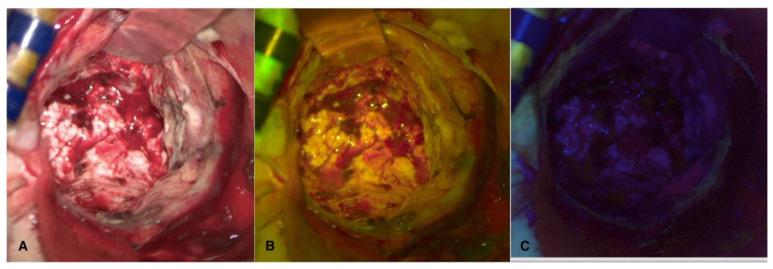 https://cdn.ncbi.nlm.nih.gov/pmc/blobs/f495/11353032/c054d9f55709/cancers-16-02771-g003.jpg