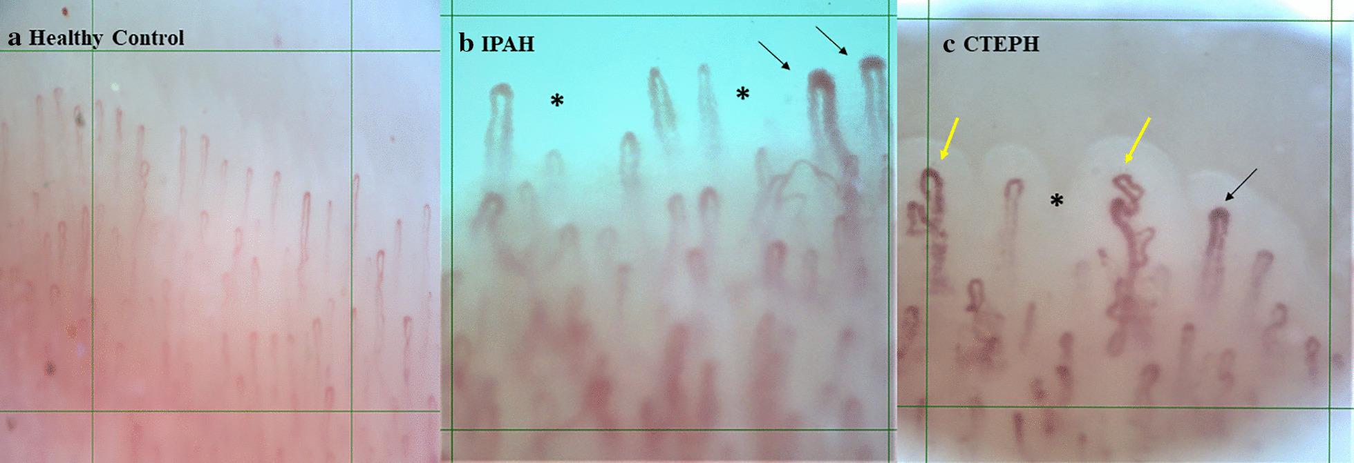 https://cdn.ncbi.nlm.nih.gov/pmc/blobs/f495/7819216/4f1357bfcb96/12931_2021_1622_Fig1_HTML.jpg