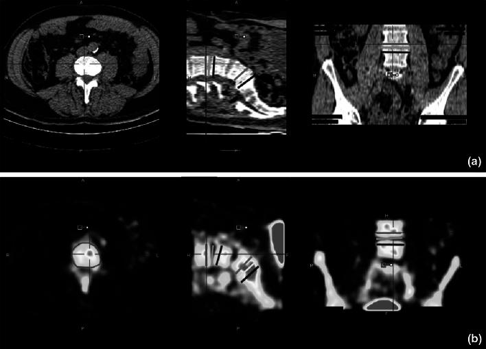 https://cdn.ncbi.nlm.nih.gov/pmc/blobs/f498/4624823/cef6d6f009d3/12149_2015_1008_Fig1_HTML.jpg