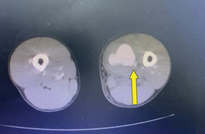 https://cdn.ncbi.nlm.nih.gov/pmc/blobs/f499/12333753/ad6daabd9b8e/ms9-87-5316-g002.jpg