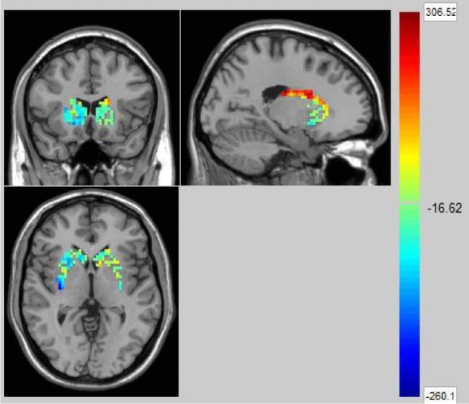 https://cdn.ncbi.nlm.nih.gov/pmc/blobs/f49b/7094756/9fcb894c9afb/fpsyt-11-00198-g002.jpg