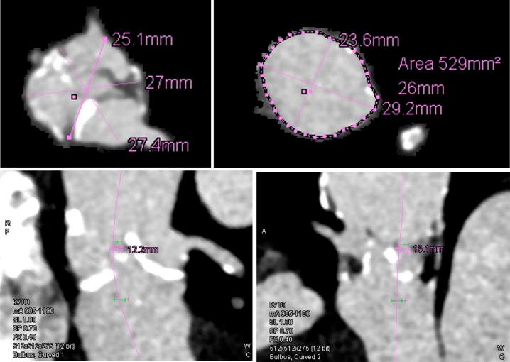 https://cdn.ncbi.nlm.nih.gov/pmc/blobs/f49f/8993451/1154b52c3cdf/jmc-13-172-g002.jpg