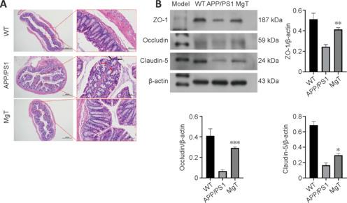 https://cdn.ncbi.nlm.nih.gov/pmc/blobs/f4a0/11034594/4680c2554277/NRR-19-2281-g009.jpg