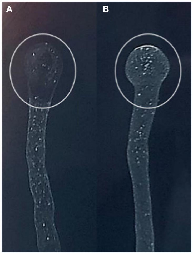 https://cdn.ncbi.nlm.nih.gov/pmc/blobs/f4ac/11165191/4bb72788e668/fmicb-15-1412650-g005.jpg
