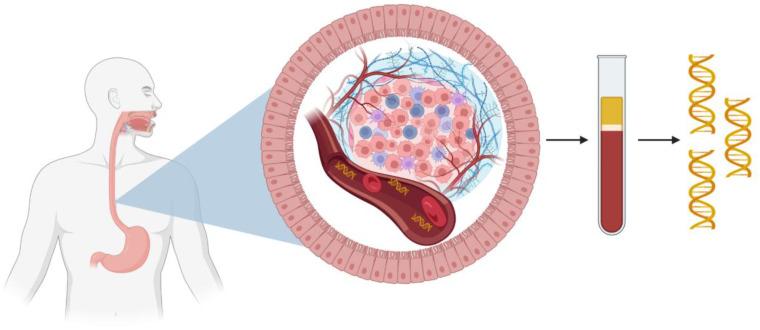 https://cdn.ncbi.nlm.nih.gov/pmc/blobs/f4b6/12390799/124d5c9c44ee/fonc-15-1622984-g002.jpg