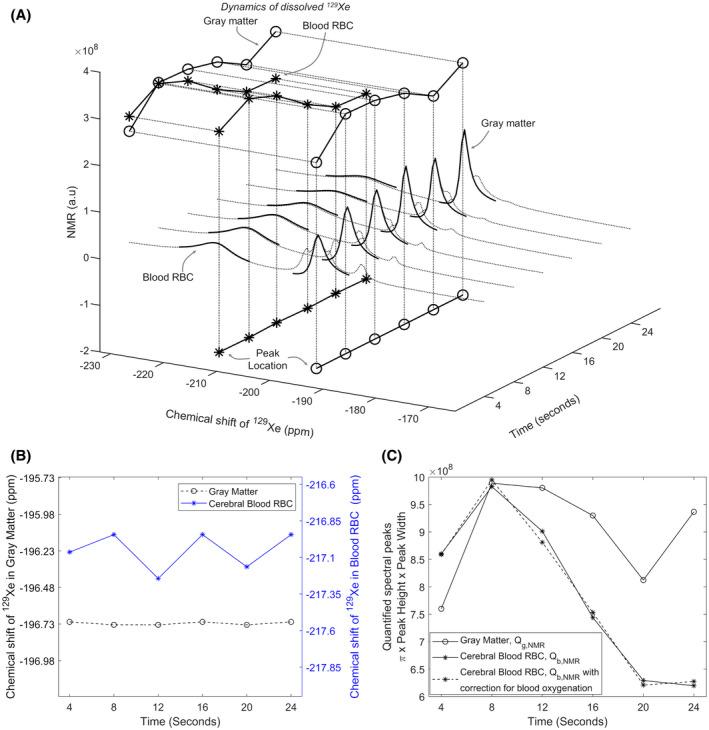 https://cdn.ncbi.nlm.nih.gov/pmc/blobs/f4c0/7986241/c223c90bbb34/MRM-85-2939-g004.jpg