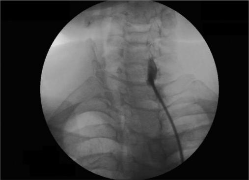 https://cdn.ncbi.nlm.nih.gov/pmc/blobs/f4c5/3057247/56ac78ad327e/IJA-55-52-g005.jpg