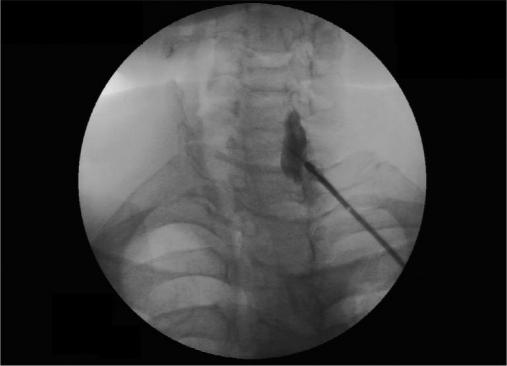 https://cdn.ncbi.nlm.nih.gov/pmc/blobs/f4c5/3057247/a37d32426d1b/IJA-55-52-g006.jpg