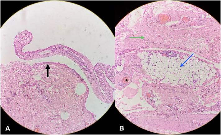 https://cdn.ncbi.nlm.nih.gov/pmc/blobs/f4d0/12269877/fe0bdab44617/gr3.jpg