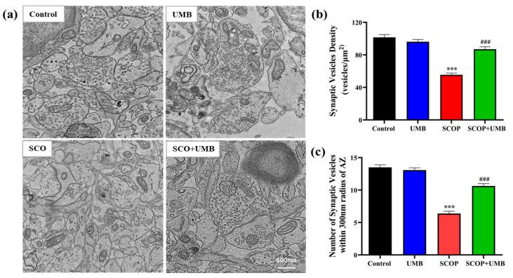 https://cdn.ncbi.nlm.nih.gov/pmc/blobs/f4d3/10221769/d36524d9a4c7/nutrients-15-02351-g011.jpg