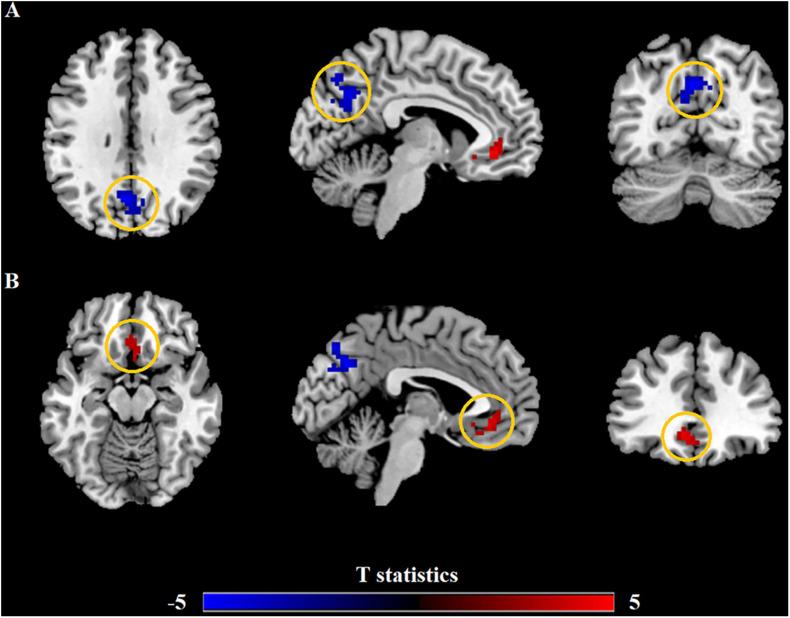 https://cdn.ncbi.nlm.nih.gov/pmc/blobs/f4d7/8317644/9307cb246a0b/fnins-15-697299-g001.jpg