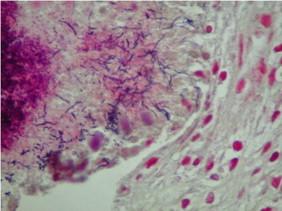 https://cdn.ncbi.nlm.nih.gov/pmc/blobs/f4e1/3921643/c6721986d20c/gr3.jpg