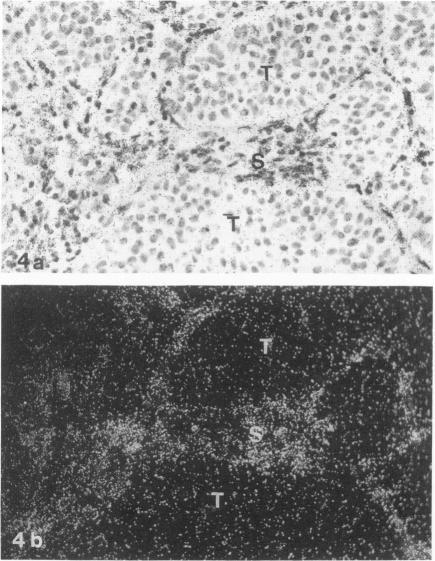 https://cdn.ncbi.nlm.nih.gov/pmc/blobs/f4e6/1886929/3493f36404c4/amjpathol00077-0302-c.jpg