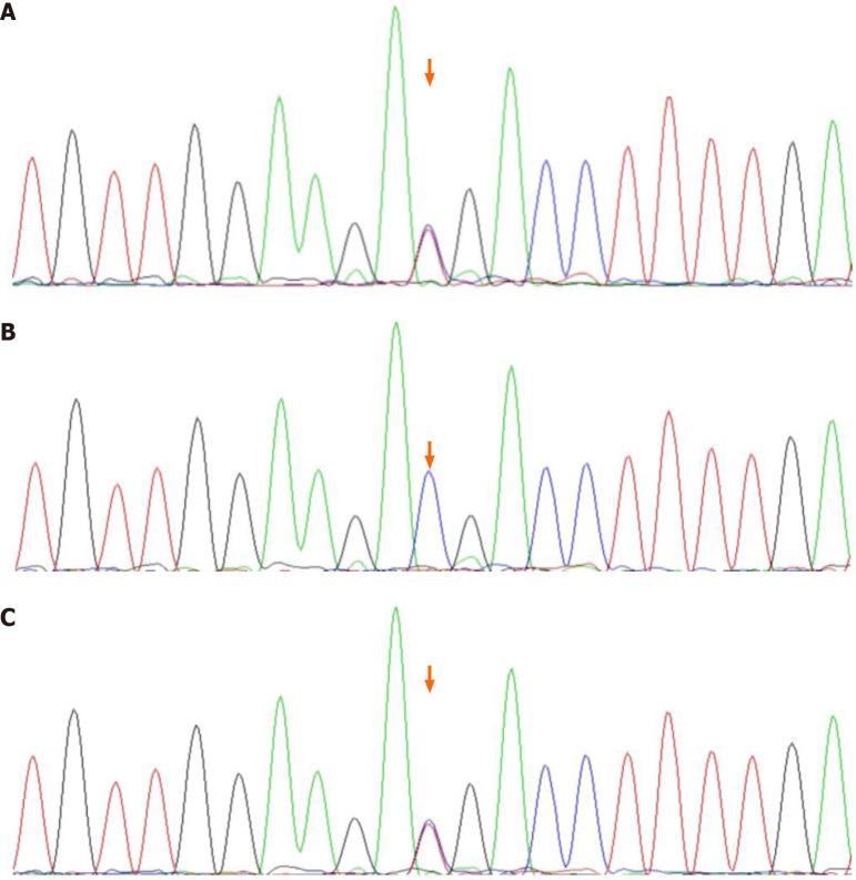 https://cdn.ncbi.nlm.nih.gov/pmc/blobs/f4e8/7716326/47ede8826c16/WJCC-8-5678-g004.jpg