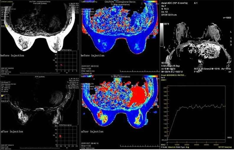 https://cdn.ncbi.nlm.nih.gov/pmc/blobs/f4ea/10589282/035715f95f9e/41598_2023_45079_Fig4_HTML.jpg