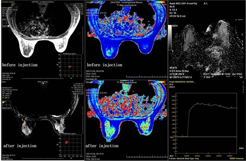 https://cdn.ncbi.nlm.nih.gov/pmc/blobs/f4ea/10589282/2c6eec02bb1c/41598_2023_45079_Fig3_HTML.jpg