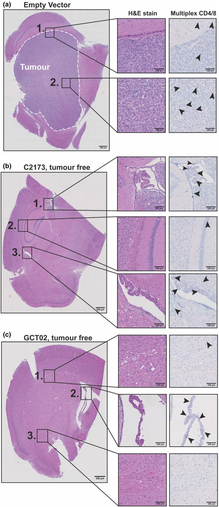https://cdn.ncbi.nlm.nih.gov/pmc/blobs/f4ed/8106904/4ea841a10c8c/CTI2-10-e1283-g005.jpg