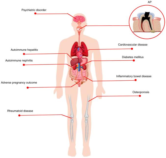 https://cdn.ncbi.nlm.nih.gov/pmc/blobs/f4f7/10249585/82951286bf55/IJMM-52-1-05263-g00.jpg