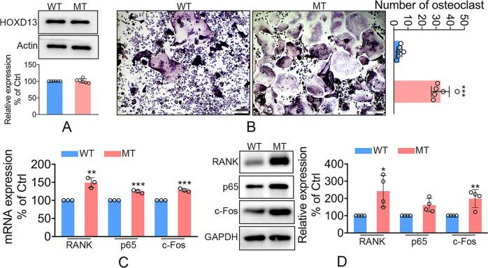 https://cdn.ncbi.nlm.nih.gov/pmc/blobs/f4f9/9941469/93e203ee1ba5/41419_2023_5681_Fig3_HTML.jpg