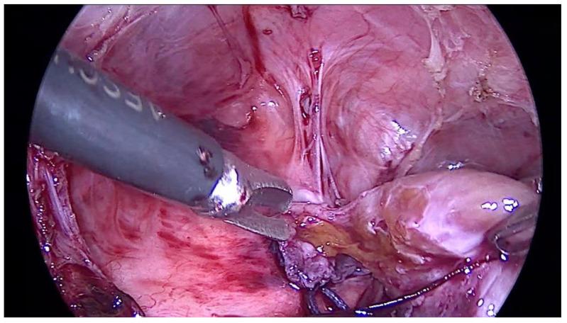 https://cdn.ncbi.nlm.nih.gov/pmc/blobs/f502/8948779/fb4688d35c4d/pediatrrep-14-00020-g002.jpg