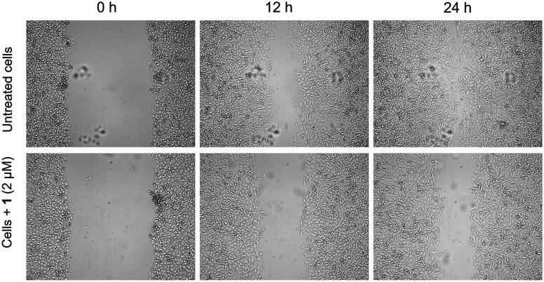 https://cdn.ncbi.nlm.nih.gov/pmc/blobs/f508/11975047/d9c0f52cba64/d4md00964a-f5.jpg