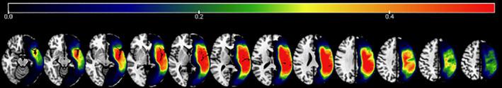 https://cdn.ncbi.nlm.nih.gov/pmc/blobs/f508/7978124/5530942ad923/HBM-42-1682-g003.jpg