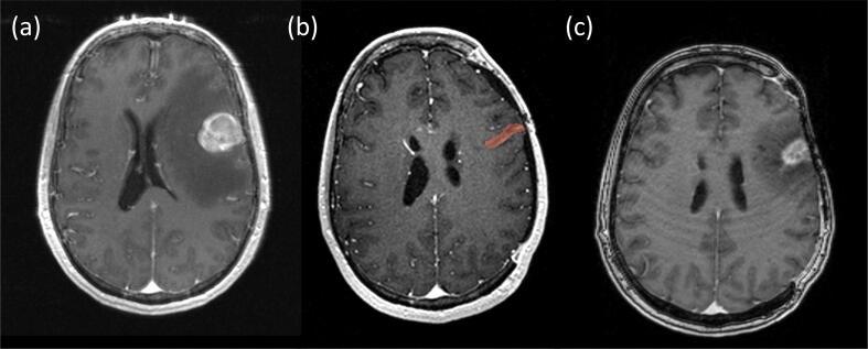 https://cdn.ncbi.nlm.nih.gov/pmc/blobs/f50d/8164004/9423ffb4afce/gr1.jpg