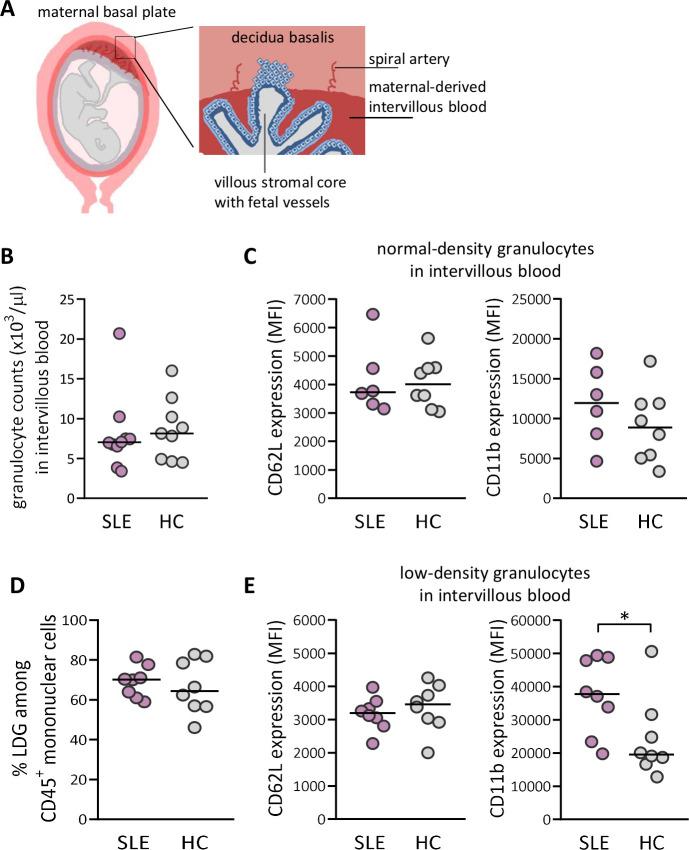 https://cdn.ncbi.nlm.nih.gov/pmc/blobs/f50f/7942245/df628d08f1d1/lupus-2020-000463f02.jpg