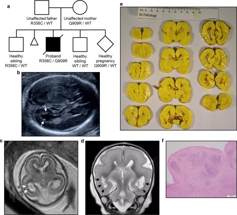 https://cdn.ncbi.nlm.nih.gov/pmc/blobs/f516/7916305/cd8dd6abcc7f/12920_2021_911_Fig1_HTML.jpg