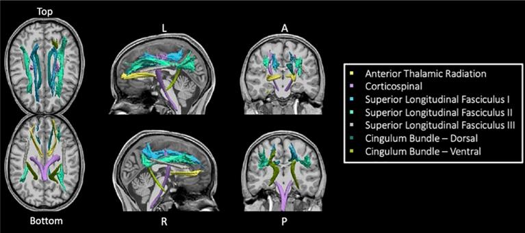 https://cdn.ncbi.nlm.nih.gov/pmc/blobs/f519/10867155/eccd495484d4/fpsyt-15-1240502-g001.jpg