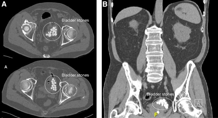https://cdn.ncbi.nlm.nih.gov/pmc/blobs/f51e/5314972/e82d6b9734dd/fig-1.jpg