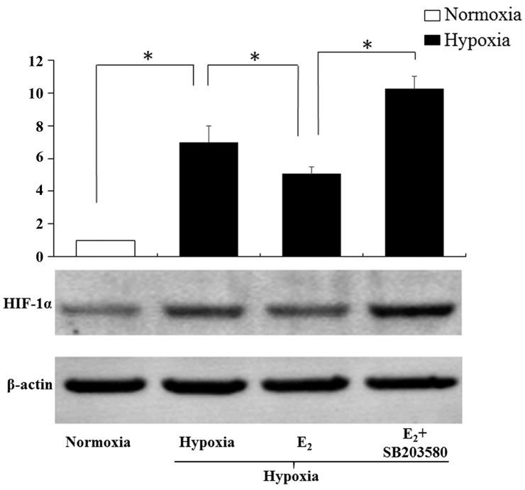 https://cdn.ncbi.nlm.nih.gov/pmc/blobs/f52e/5627877/69e0959c0c2c/IJMM-40-05-1347-g06.jpg