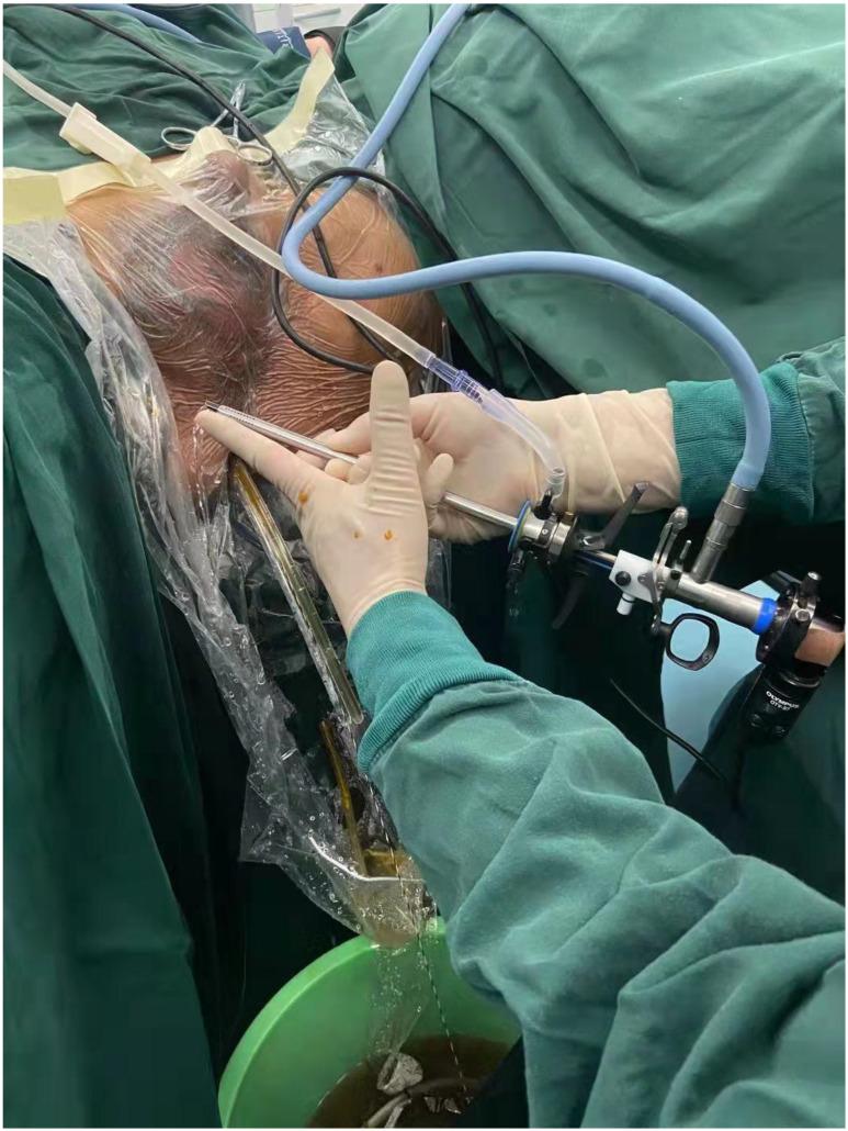 https://cdn.ncbi.nlm.nih.gov/pmc/blobs/f532/8965121/20dcb57452d0/jcav13p1679g001.jpg