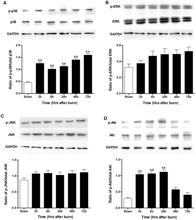 https://cdn.ncbi.nlm.nih.gov/pmc/blobs/f533/3547934/389ee5da57cf/pone.0054593.g005.jpg