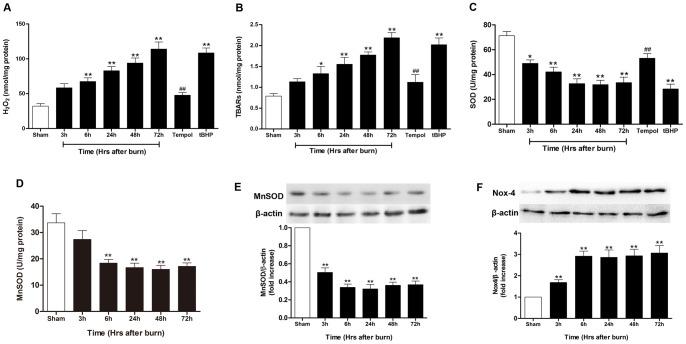 https://cdn.ncbi.nlm.nih.gov/pmc/blobs/f533/3547934/aee169002a84/pone.0054593.g004.jpg
