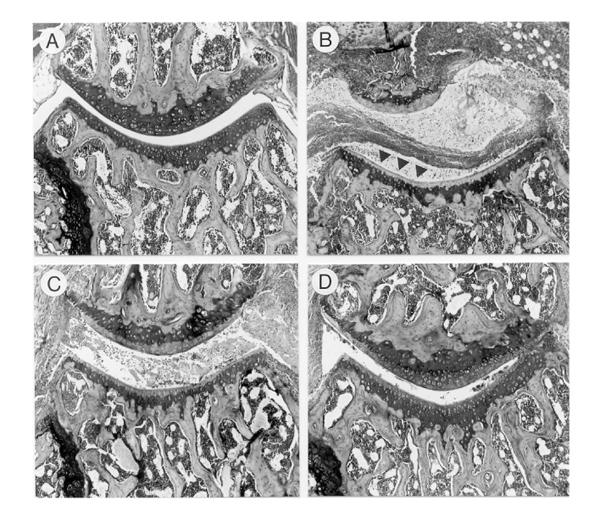 https://cdn.ncbi.nlm.nih.gov/pmc/blobs/f538/17779/34c6f59133c5/ar-1-1-081-5.jpg