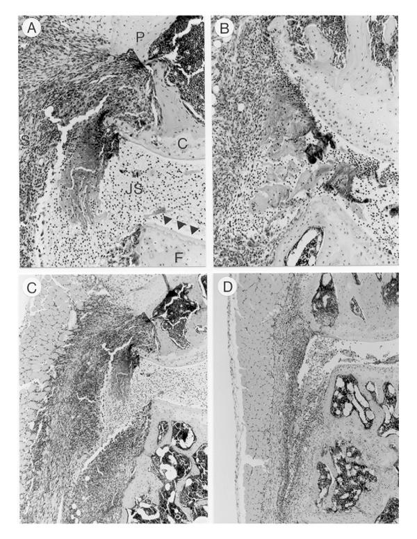https://cdn.ncbi.nlm.nih.gov/pmc/blobs/f538/17779/c71723c208c4/ar-1-1-081-4.jpg