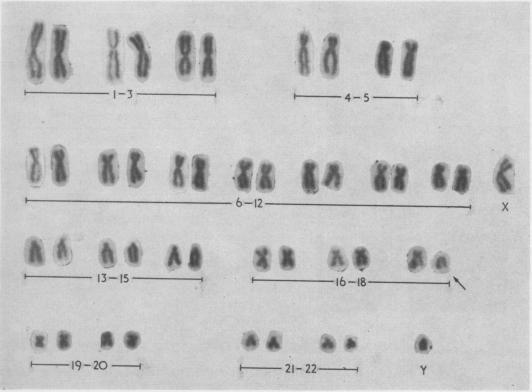 https://cdn.ncbi.nlm.nih.gov/pmc/blobs/f539/1468842/ad318d199f27/jmedgene00373-0108-a.jpg