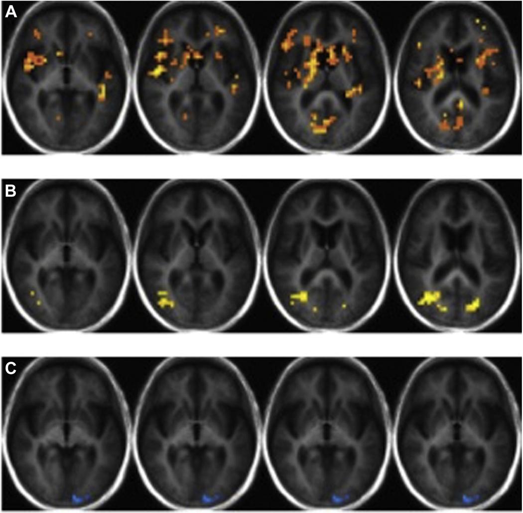 https://cdn.ncbi.nlm.nih.gov/pmc/blobs/f53b/7605173/caec505b3484/nihms-1586010-f0001.jpg