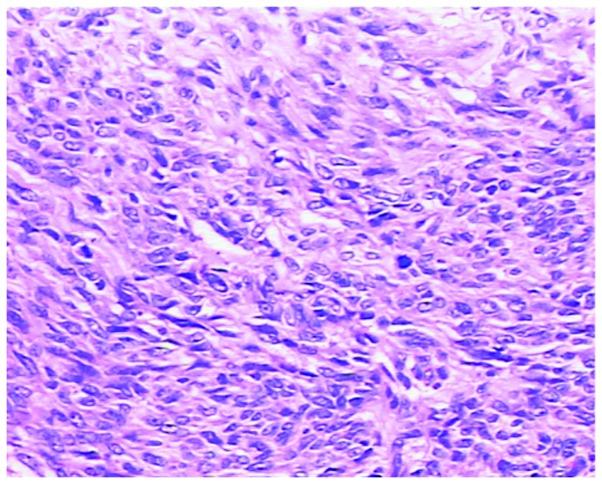 https://cdn.ncbi.nlm.nih.gov/pmc/blobs/f54a/3997669/8cf005a096ff/OL-07-05-1427-g02.jpg