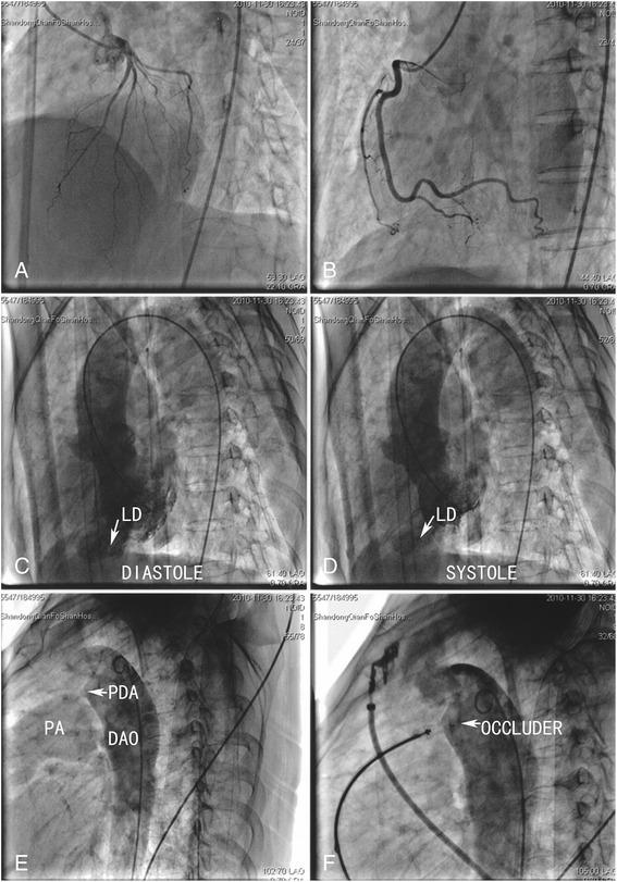https://cdn.ncbi.nlm.nih.gov/pmc/blobs/f550/4647487/aa8e2692de55/12872_2015_146_Fig4_HTML.jpg