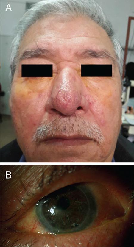 https://cdn.ncbi.nlm.nih.gov/pmc/blobs/f552/8715657/ac406a7f121b/TJO-51-338-g3.jpg