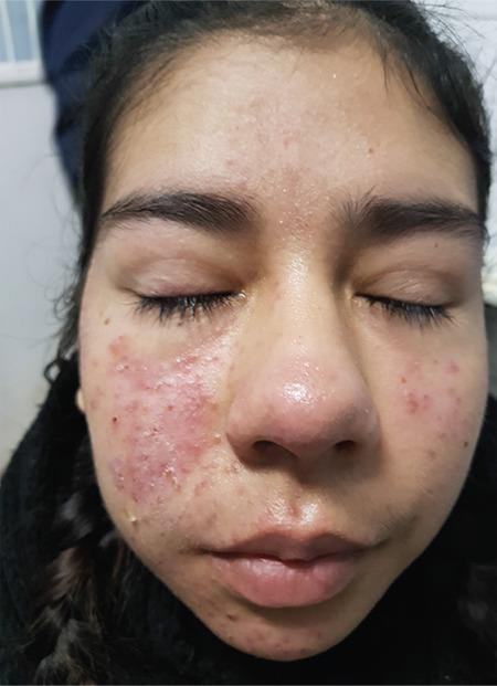 https://cdn.ncbi.nlm.nih.gov/pmc/blobs/f552/8715657/d7c4b460de05/TJO-51-338-g1.jpg