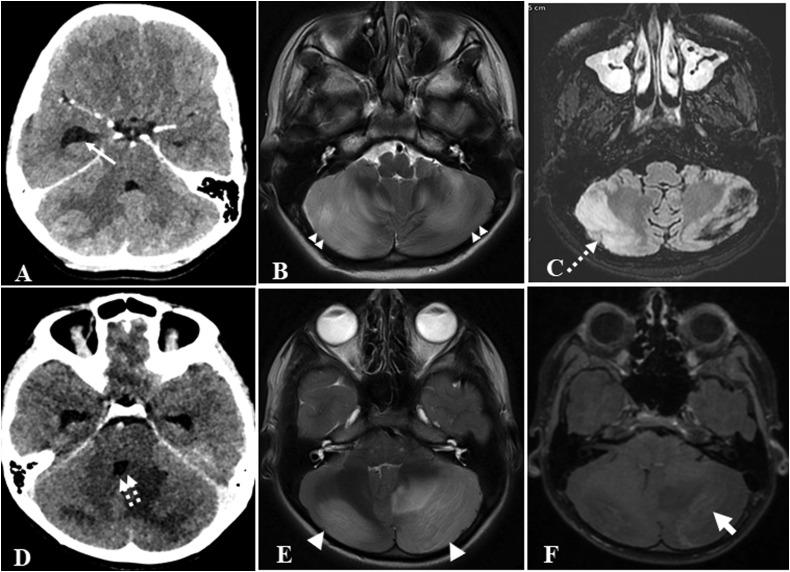 https://cdn.ncbi.nlm.nih.gov/pmc/blobs/f554/7997024/76ae30806e7d/gr1_lrg.jpg